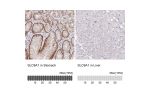 Immunohistochemistry analysis in human stomach and liver tissues using HPA048532 antibody. Corresponding SLC9A1 RNA-seq data are presented for the same tissues.