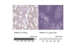 Immunohistochemistry analysis in human kidney and lymph node tissues using Anti-TMEM27 antibody. Corresponding TMEM27 RNA-seq data are presented for the same tissues.