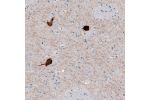 Immunohistochemical staining of human caudate nucleus shows strong cytoplasmic positivity in a large neurons.