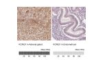 Immunohistochemistry analysis in human adrenal gland and endometrium tissues using HPA048553 antibody. Corresponding KCNQ1 RNA-seq data are presented for the same tissues.
