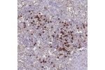 Immunohistochemical staining of human spleen shows strong membranous and cytoplasmic positivity in cells in red pulp.