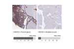 Immunohistochemistry analysis in human thyroid gland and skeletal muscle tissues using HPA048560 antibody. Corresponding HDAC8 RNA-seq data are presented for the same tissues.