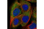 Immunofluorescent staining of human cell line A-431 shows localization to cytosol.