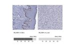 Immunohistochemistry analysis in human skin and liver tissues using HPA048662 antibody. Corresponding MLANA RNA-seq data are presented for the same tissues.