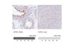 Immunohistochemistry analysis in human testis and liver tissues using HPA048687 antibody. Corresponding ACR RNA-seq data are presented for the same tissues.