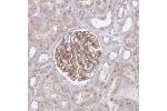 Immunohistochemical staining of human kidney shows strong membranous positivity in cells in glomeruli.