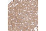Immunohistochemical staining of human liver shows weak cytoplasmic positivity in hepatocytes.