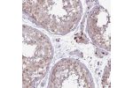 Immunohistochemical staining of human testis shows strong nuclear positivity in Leydig cells.