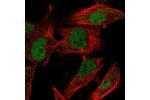 Immunofluorescent staining of human cell line U-251 MG shows localization to nucleoplasm.