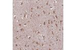 Immunohistochemical staining of human cerebral cortex shows strong cytoplasmic positivity in neurons.