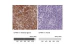 Immunohistochemistry analysis in human adrenal gland and tonsil tissues using Anti-EPHX1 antibody. Corresponding EPHX1 RNA-seq data are presented for the same tissues.