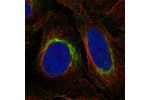 Immunofluorescent staining of human cell line U-2 OS shows localization to intermediate filaments.