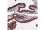 Immunohistochemical staining of human fallopian tube shows moderate cytoplasmic positivity in glandular cells.