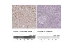 Immunohistochemistry analysis in human cerebral cortex and pancreas tissues using Anti-FAM69C antibody. Corresponding FAM69C RNA-seq data are presented for the same tissues.