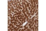 Immunohistochemical staining of human liver shows strong cytoplasmic positivity in hepatocytes.