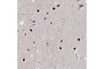 Immunohistochemical staining of human hippocampus shows strong nuclear positivity in neuronal cells.