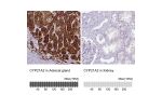 Immunohistochemistry analysis in human adrenal gland and kidney tissues using HPA048979 antibody. Corresponding CYP21A2 RNA-seq data are presented for the same tissues.
