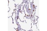 Immunohistochemical staining of human lung shows strong cytoplasmic positivity in macrophages.