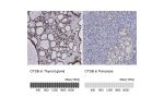 Immunohistochemistry analysis in human thyroid gland and pancreas tissues using Anti-CTSB antibody. Corresponding CTSB RNA-seq data are presented for the same tissues.