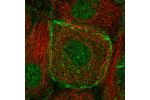 Immunofluorescent staining of human cell line A-431 shows localization to nucleoplasm & plasma membrane.
