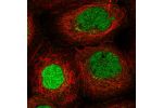 Immunofluorescent staining of human cell line A-431 shows localization to nucleoplasm & vesicles.