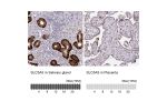 Immunohistochemistry analysis in human salivary gland and placenta tissues using HPA049055 antibody. Corresponding SLC5A5 RNA-seq data are presented for the same tissues.