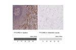 Immunohistochemistry analysis in human spleen and skeletal muscle tissues using HPA049074 antibody. Corresponding PYCARD RNA-seq data are presented for the same tissues.