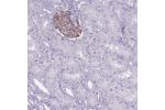 Immunohistochemical staining of human kidney shows moderate membranous positivity in cells in glomeruli.