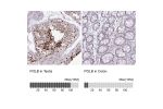 Immunohistochemistry analysis in human testis and colon tissues using HPA049104 antibody. Corresponding POLB RNA-seq data are presented for the same tissues.