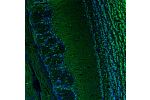 Immunofluorescence staining of mouse brain shows moderate to strong positivity in neurons in the olfactory bulb.
