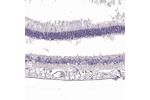Immunohistochemical staining of human eye, retina shows weak granular cytoplasmic positivity in nerve fibers in plexiform layers.