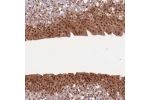 Immunohistochemical staining of human urinary bladder shows nuclear and cytoplasmic positivity in urothelial cells.