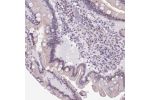 Immunohistochemical staining of human duodenum shows weak membranous positivity in glandular cells.
