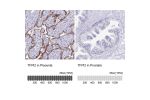 Immunohistochemistry analysis in human placenta and prostate tissues using Anti-TFPI2 antibody. Corresponding TFPI2 RNA-seq data are presented for the same tissues.