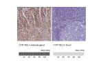 Immunohistochemistry analysis in human adrenal gland and tonsil tissues using HPA049171 antibody. Corresponding CYP11B2 RNA-seq data are presented for the same tissues.