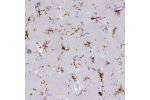 Immunohistochemical staining of human cerebral cortex shows strong membranous positivity in glial cells.
