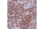 Immunohistochemical staining of human pancreas shows distinct cytoplasmic positivity in exocrine glandular cells.