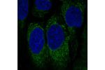 Immunofluorescent staining of human cell line CACO-2 shows localization to endoplasmic reticulum.
