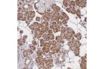 Immunohistochemical staining of human salivary gland shows strong cytoplasmic positivity in glandular cells.