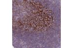 Immunohistochemical staining of human tonsil shows distinct reticular positivity in germinal center.