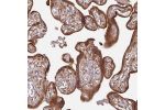 Immunohistochemical staining of human placenta shows cytoplasmic positivity in trophoblastic cells.