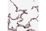 Immunohistochemical staining of human lung shows strong cytoplasmic positivity in a fraction of pneumocytes.