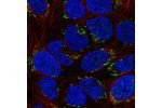 Immunofluorescent staining of human cell line RT4 shows localization to the Golgi apparatus.