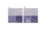 Immunohistochemical staining of human cerebral cortex, liver, lymph node and thymus using Anti-UHRF1 antibody HPA049408 (A) shows similar protein distribution across tissues to independent antibody HPA055446 (B).