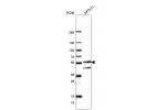 Western blot analysis in human cell line RT-4 and human cell line U-251 MG.