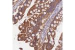 Immunohistochemical staining of human small intestine shows strong cytoplasmic positivity in glandular cells.