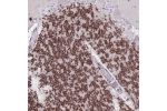 Immunohistochemical staining of human cerebellum shows strong nuclear positivity in cells in granular layer.