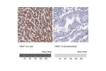Immunohistochemistry analysis in human liver and endometrium tissues using HPA049552 antibody. Corresponding HAO1 RNA-seq data are presented for the same tissues.