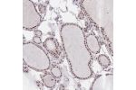 Immunohistochemical staining of human Thyroid gland shows moderate nuclear positivity in glandular cells.