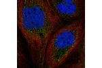 Immunofluorescent staining of human cell line A-431 shows localization to vesicles.